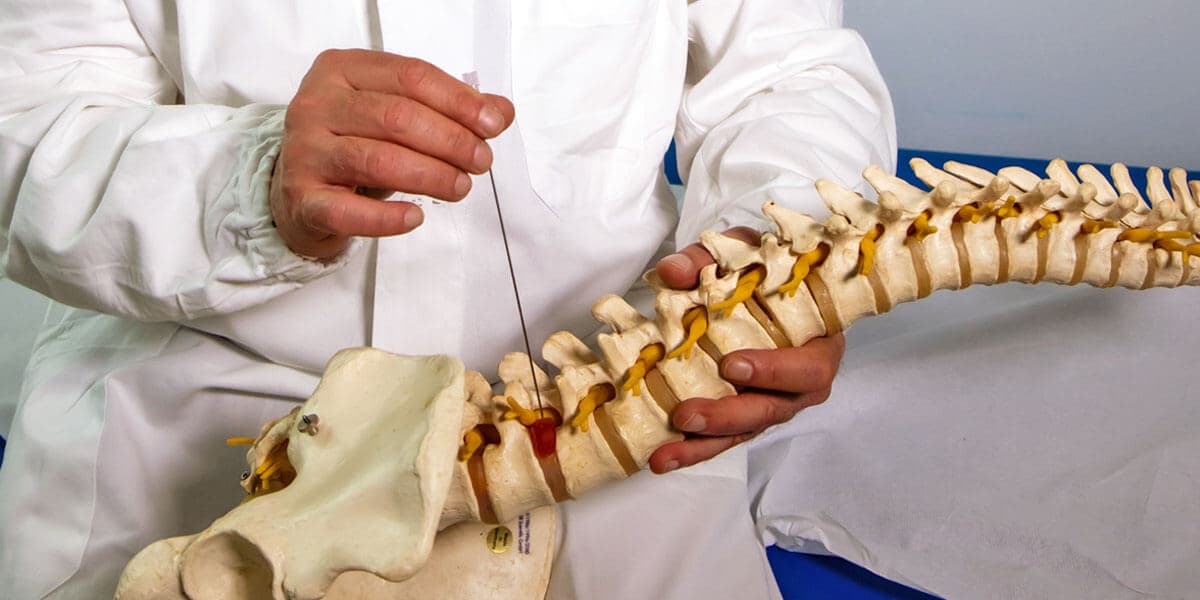 Перкутанна лазерна дискектомія