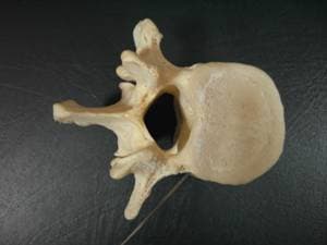 Доступ через корень дуги и суставного отростка